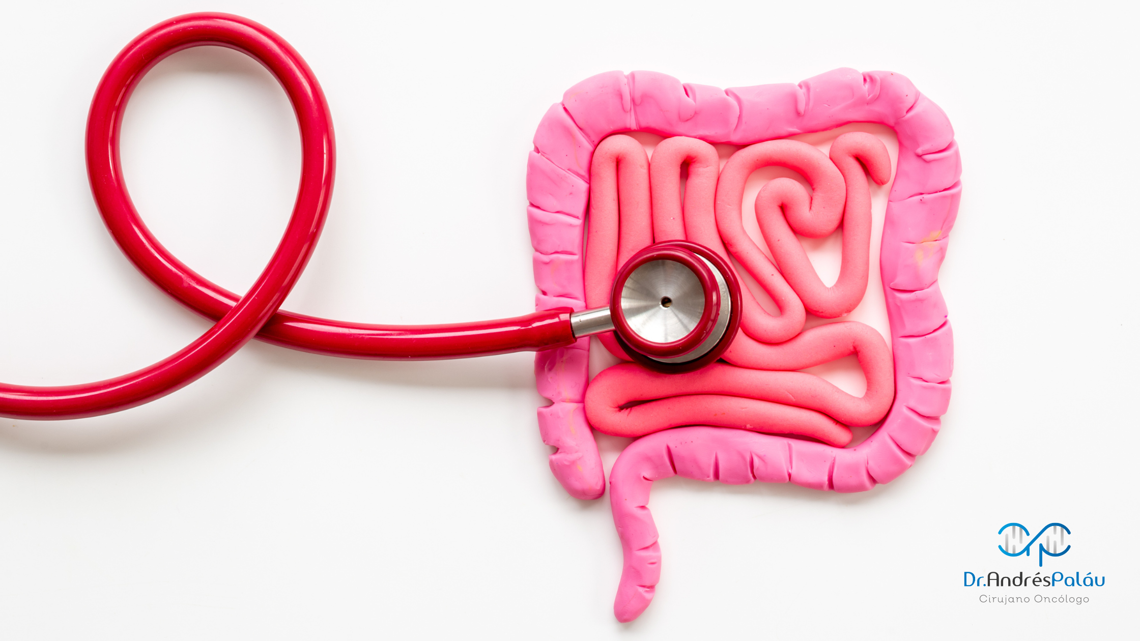 Cáncer de Colon - Dr. Andrés Paláu