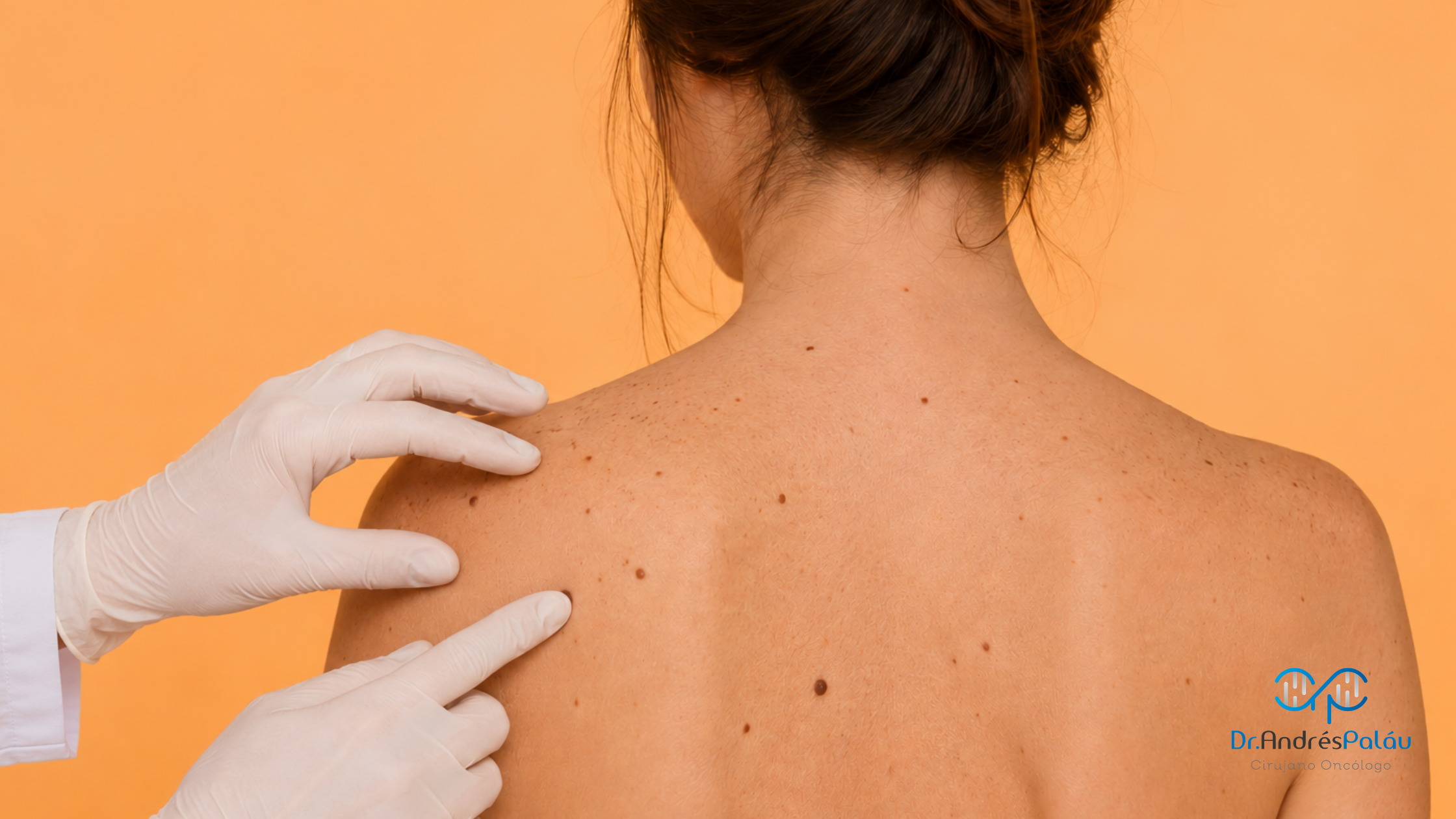 Cáncer de piel - Dr. Andrés Paláu
